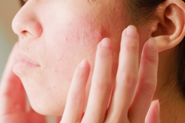 30代の肌悩み、肌をチェックする女性